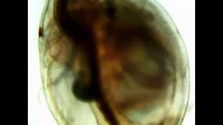 Daphnia Heart Rate Diphenhydramine [upl. by Richy431]