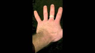 Osteoarthritis How to get rid of arthritis in the hands and RSI [upl. by Swagerty]