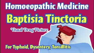 Baptisia Tinctoria 30 Homoeopathic Medicine Uses  Baptisia Mother Tincture  Baptisia Drug Picture [upl. by Bridie]