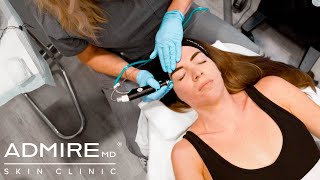 Hydrafacial Syndeo  Take Your Skin To The Next Level [upl. by Jaymie]