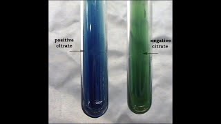 Citrate Utilization Test [upl. by Eimarrej]