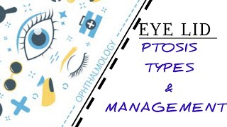 EYELID LECTURE7 PTOSIS TYPES ETIOLOGY TREATMENT [upl. by Deborah703]