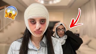 مقلب عملية التجميل بأمي  عصبت وضربتني [upl. by Dranreb]