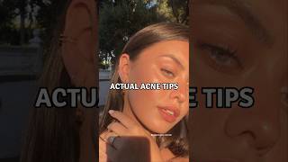 6 Actual Acne Tips viralshorts acnetreatment acnescars [upl. by Aienahs911]