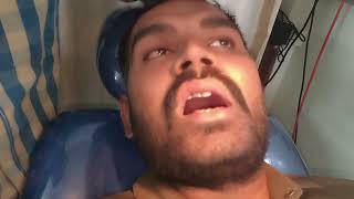 Symptoms of erupting wisdom tooth abscess ll ડહાપણ દાઢ નો દુઃખાવો dental viral wisdom tooth [upl. by Aggri]