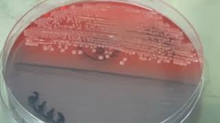 Klebsiella oxytoca on CLED Agar [upl. by Eilesor332]