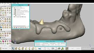 Subperiosteal Implants using Geomagic freeform and 3D printing [upl. by Sofia666]