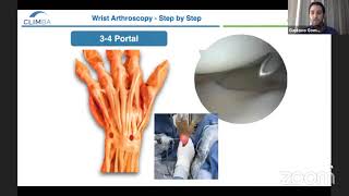 Wrist Arthroscopy Step by Step [upl. by Nwadahs]