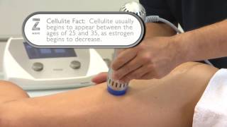 ZWave for Cellulite  Thighs Treatment [upl. by Feeney]