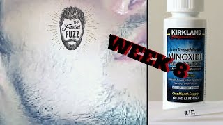 Minoxidil Beard  Week 8  Minoxidil 5 for Beard Growth  FacialFuzzFridays [upl. by Iden]