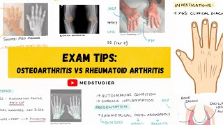 Exam strategy Osteoarthritis vs Rheumatoid Arthritis  MedStudier [upl. by Bowerman]