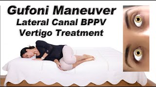 Gufoni Maneuver to Treat BPPV of the Lateral Canal Ageotropic and Geotropic Variations [upl. by Cheryl330]