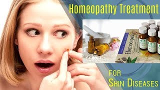 Sulphur for Skin Diseases  Pimples  Homeopathy  Dr Ketan Shah  MD Homeopathic [upl. by Viridi]