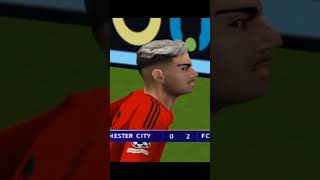 Pes de psp [upl. by Eipper]