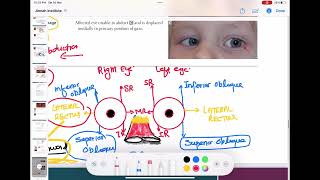 trochlear and abducens nerve palsy ophthalmology 30  First Aid USMLE Step 1 in UrduHindi [upl. by Idnir]