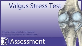 Valgus Stress Test  Medial Collateral Ligament [upl. by Enna]