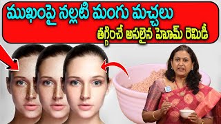 How to Remove Dark Spots  Home Remedy for Pigmentation  Face Pack Dr Joshna Pulipati iDreamDoctor [upl. by Beverlee127]