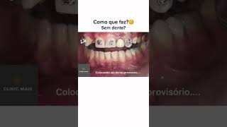 Isso é possível mesmo sem algum dente 😱 Já compartilhaaaa aparelhoortodôntico [upl. by Siulegroj]