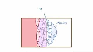 Membranous glomerulonephritis membranous nephropathy causes amp symptoms [upl. by Anizor]