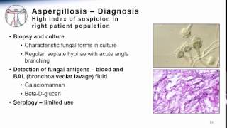 Aspergillosis [upl. by Filler]