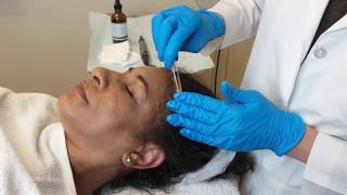 Platelet Rich Plasma HAIR THERAPY procedure with Dr Kristen Richards at Torrey Pines Dermatology [upl. by Onaireves]