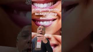 Whitening Teeth with Hydrogen Peroxide Fast Simple amp Easy  In Office to Hands On Dental Training [upl. by Klimesh]