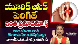 Uric Acid  జస్ట్ 4 డేస్ లో రిమూవ్ యూరిక్ యాసిడ్ లైఫ్ లో రాదు  How to reduce uric acid levels [upl. by Anegal833]