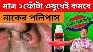 নাকের পলিপাসের শীর্য হোমিও ঔষধ l Nasal polyps homeopathic medicine l Nasal polyps homeopathic l [upl. by Lehmann]