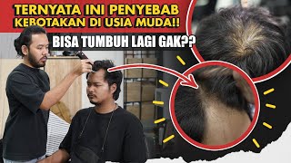 Masih Muda Kok Rambut Mulai TIPIS Begini Cara Mengatasinya… [upl. by Anailuy194]