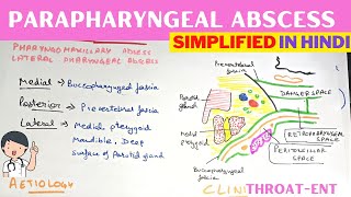 Parapharyngeal Abscess  Hindi  ENT [upl. by Fiel]