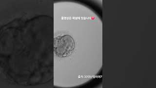 PGT 정상 통과 배아 분열과정 Embryoscope timelapse 시험관 난임 5일배양 통배 pg t염색체 배아분열과정 pgt통과배아 정상배아 [upl. by Auberta]