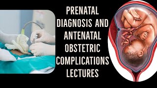 ANTENATAL OBSTETRIC COMPLICATIONS lecture 5 FETAL MALPRESENTATION important points [upl. by Eittap]