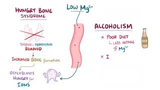 Hypomagnesemia causes symptoms diagnosis treatment pathology [upl. by Pero583]