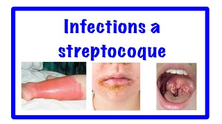 🔵infection à streptocoque 👹 streptococcies [upl. by Einnek653]