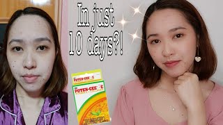 Poten Cee Collagen Review  Effective Collagen Supplement [upl. by Jeffry]