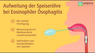 Aufweitung der Speiseröhre bei Eosinophiler Ösophagitis Arzt erklärt [upl. by Oiratnom]