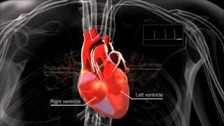 What is atrial fibrillation [upl. by Abner]