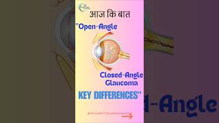 quotWhats the Difference Between Open Angle and Close Angle 👁️🫠Glaucoma ARSLIV shoryoutube [upl. by Roxane]