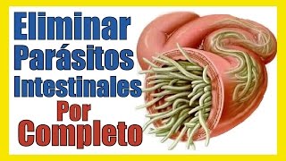 OXIUROS TRATAMIENTO para Desparasitar y Quitar PARASITOS INTESTINALES o LOMBRICES Remedios Caseros [upl. by Faustus]