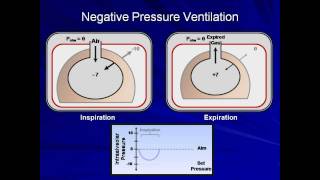 An Introduction to Mechanical Ventilation Mechanical Ventilation  Lecture 1 [upl. by Joshia]