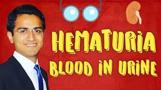 Hematuria Causes amp Diagnostic Workup of Blood in Urine [upl. by Ydnew]