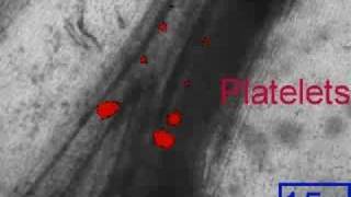 Platelet accumulation following a FeCl3 injury on mesentery [upl. by Holcomb]