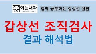 18 갑상선 조직검사 해석방법feat 즉시 수술 vs 수술하지 않고 지켜보기 [upl. by Lenahs]