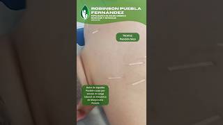 Punción Seca salud kine dolor dolorcronico kinesiologia talca bienestar acupuntura vidadana [upl. by Aibsel507]