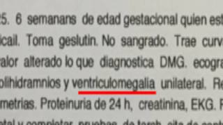 VENTRICULOMEGALIA Un Milagro Llamado Jeronimo [upl. by Koh]