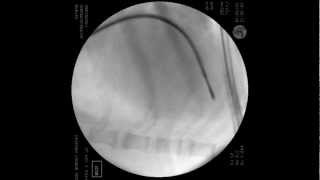 Endomyocardial biopsy in dog [upl. by Haon100]