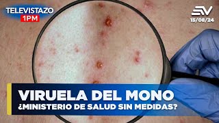 Viruela del mono ¿Ministerio de salud sin medidas  Televistazo 1PM ENVIVO🔴 [upl. by Fiona417]