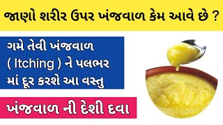 જાણો શરીર ઉપર ખંજવાળ કેમ આવે છે   ગમે તેવી ખંજવાળ  Itching  ને દૂર કરશે આ વસ્તુ  ખંજવાળ ની દવા [upl. by Licna]