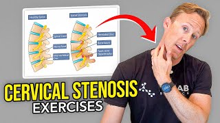 5 Exercises for Cervical Stenosis Arm Nerve Pain [upl. by Anirod981]