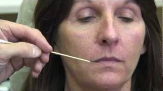 NonSurgical Facial Rejuvenation Video NASHVILLE by Dr Mark Clymer [upl. by Alvis]